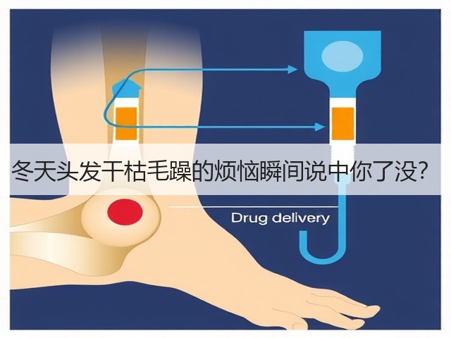 冬天头发干枯毛躁的烦恼瞬间说中你了没?(图1) 冬天头发干枯毛躁的烦恼瞬间说中你了没?(图1)