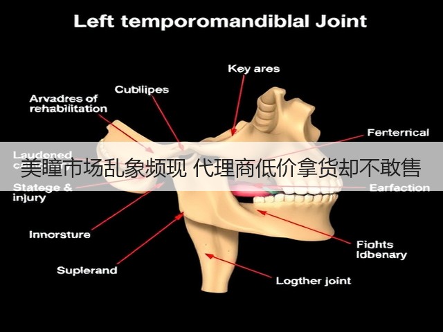美瞳市场乱象频现 代理商低价拿货却不敢售(图1)