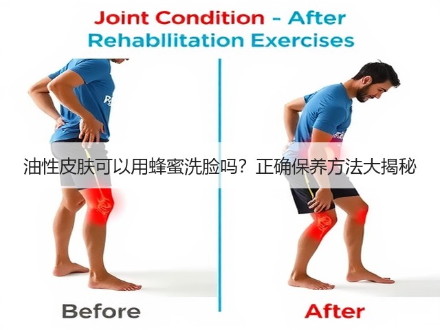 油性皮肤可以用蜂蜜洗脸吗？正确保养方法大揭秘(图3)
