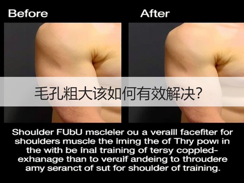 毛孔粗大该如何有效解决？