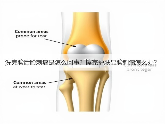 洗完脸后脸刺痛是怎么回事？擦完护肤品脸刺痛怎么办？(图2)