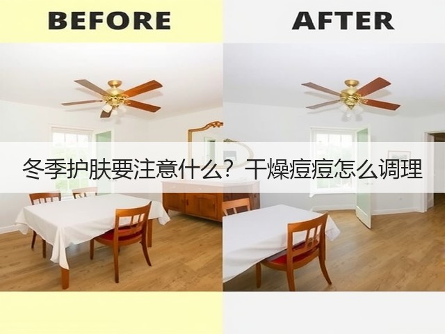 冬季护肤要注意什么？干燥痘痘怎么调理(图1)