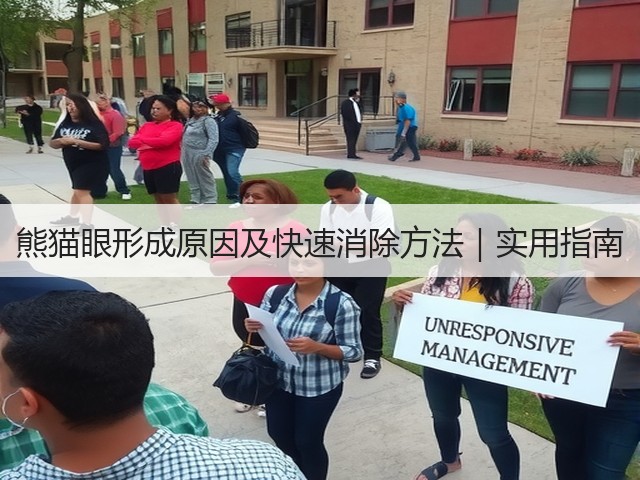 熊猫眼形成原因及快速消除方法|实用指南(图1) 熊猫眼形成原因及快速消除方法|实用指南(图1)