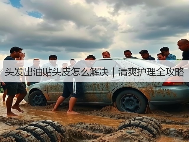 头发出油贴头皮怎么解决｜清爽护理全攻略(图2)
