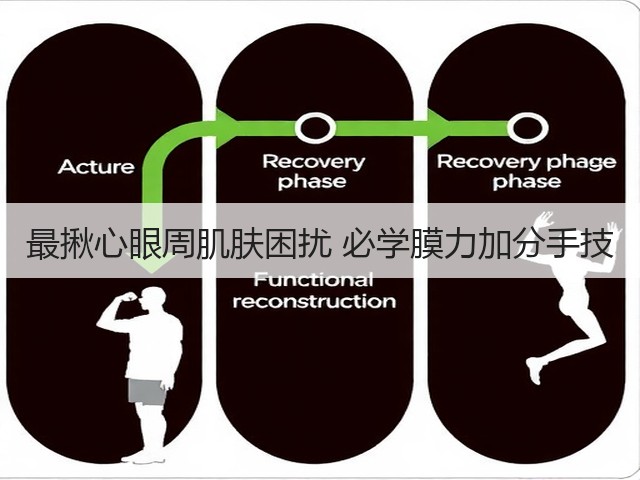 最揪心眼周肌肤困扰 必学膜力加分手技(图1) 最揪心眼周肌肤困扰 必学膜力加分手技(图1)